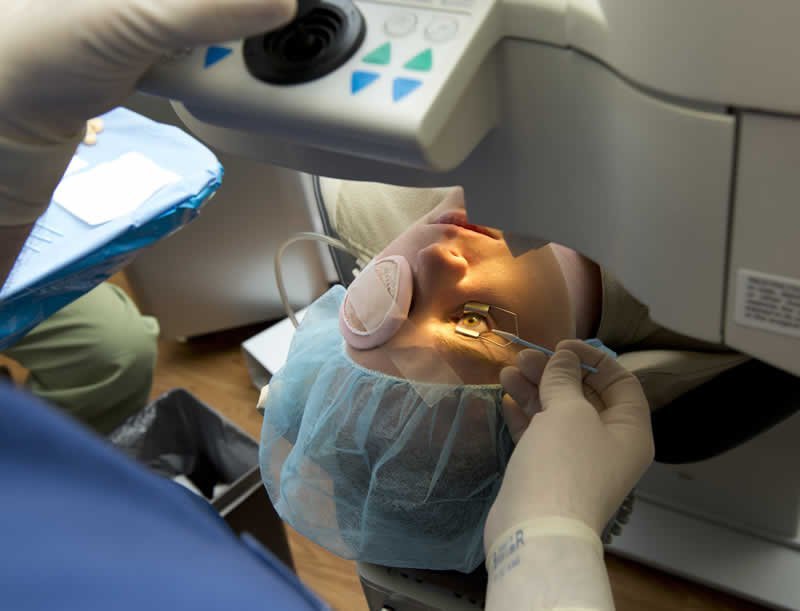 Foto de mulher realizando cirurgia refrativa com um equipamento fixado no olho para que ela não possa piscar, enquanto o laser é aplicado no olho