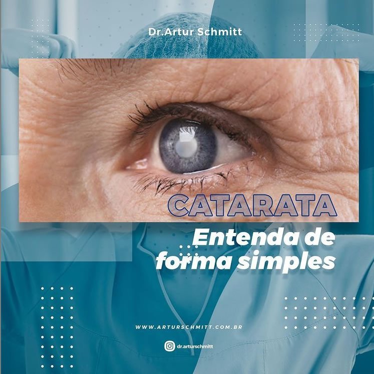 o que e a catarata e como realizar o tratamento em curitiba