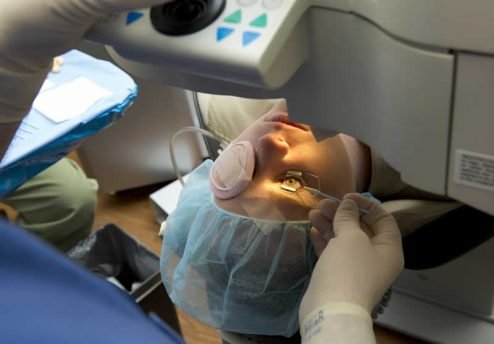 mexer-os-olhos-na-cirurgia-refrativa