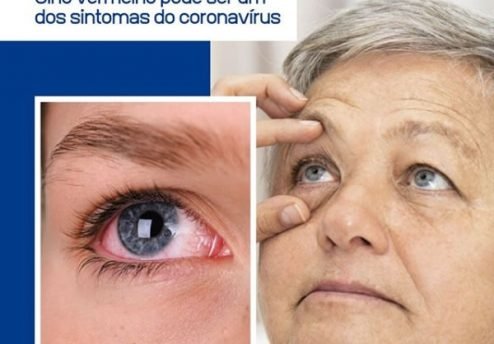 olho vermelho coronavirus