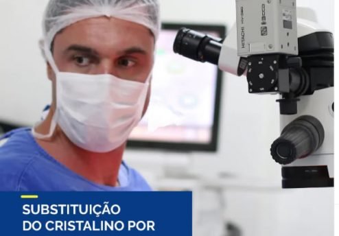 substituição do cristalino por lente intraocular