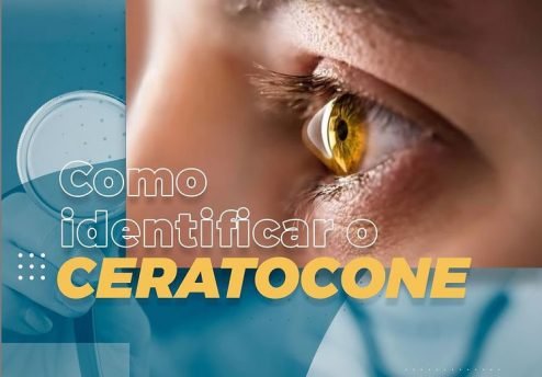 como identificar o ceratocone em curitiba