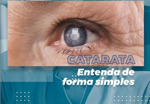 o que e a catarata e como realizar o tratamento em curitiba