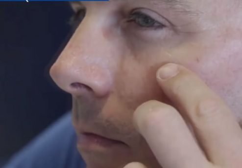 o que fazer quando os olhos tremem