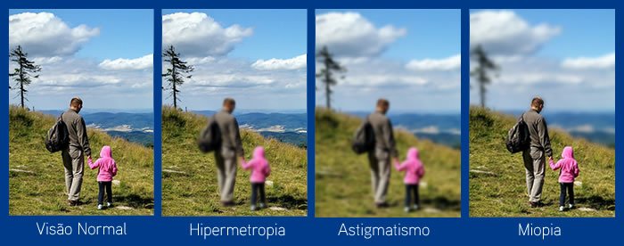 cirurgia refrativa em curitiba tratamento miopia hipermetropia astigmatismo