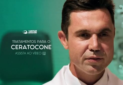 tratamento do ceratocone em curitiba médico especialista