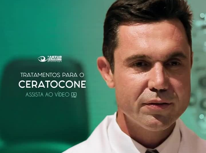 tratamento do ceratocone em curitiba médico especialista